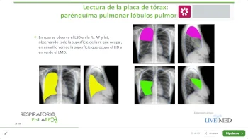 Diapositiva de una presentación del curso de Interpretación Radiografía de Tórax